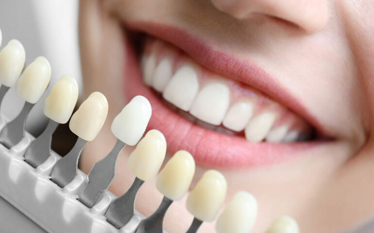 Cosmetic Dentistry